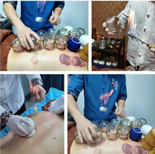 NIVKART Chinese Medical Magnetic Acupuncture Vacuum Cupping Set OF 16 |Cupping therapy set | Accupuncture Cupping Therapy For Pain Relief Anti Slip | Hijama Fire Glass Cupping Set - nivkart.com